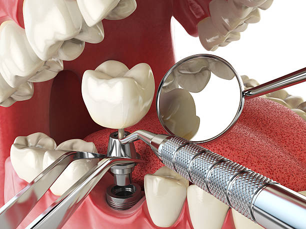 Best Urgent Dental Care for Toothaches in Mounds, OK